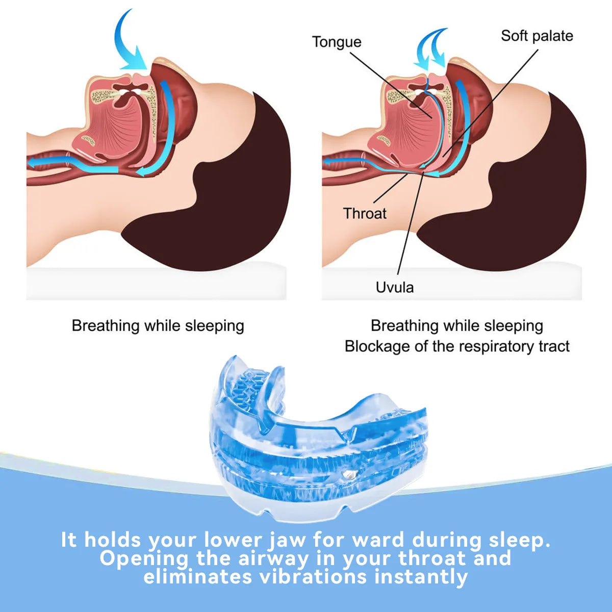 Adjustable Anti Snoring Mouthpiece